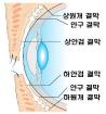 결막