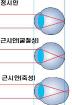 근시안